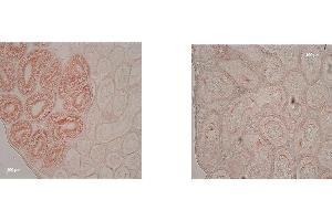 Immunohistochemistry (IHC) image for anti-Indoleamine 2,3-Dioxygenase 1 (IDO1) antibody (ABIN1043819)