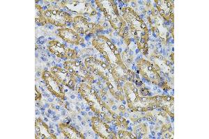 Immunohistochemistry of paraffin-embedded mouse kidney using SPTLC1 Antibody (ABIN5974083) at dilution of 1/100 (40x lens). (SPTLC1 抗体)