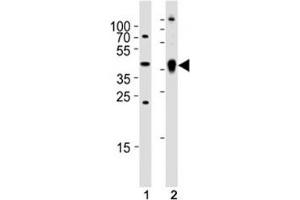Western blot analysis of (1) zebrafish brain and (2) whole zebrafish tissue lysate using Ada antibody. (ADA 抗体  (AA 114-148))