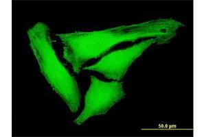 Immunofluorescence of purified MaxPab antibody to KIFC3 on HeLa cell. (KIFC3 抗体  (AA 1-687))