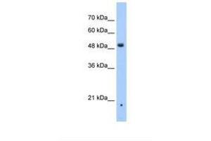 Image no. 1 for anti-Zinc Finger, DHHC-Type Containing 16 (ZDHHC16) (AA 111-160) antibody (ABIN6738666)