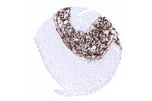 placenta mature amnion and chorion (Recombinant PLAP 抗体)