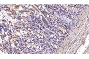 Detection of ASPH in Human Small intestine Tissue using Monoclonal Antibody to Aspartate Beta Hydroxylase (ASPH) (Aspartate beta Hydroxylase 抗体  (AA 345-758))