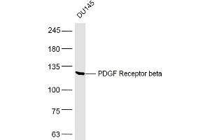 DU145 lysates probed with PDGF Receptor beta Polyclonal Antibody, Unconjugated  at 1:500 dilution and 4˚C overnight incubation. (PDGFRB 抗体  (AA 981-1066))