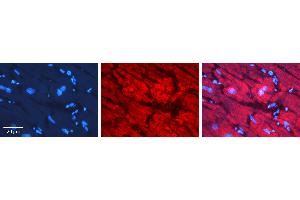 Rabbit Anti-NXF1 Antibody   Formalin Fixed Paraffin Embedded Tissue: Human heart Tissue Observed Staining: Cytoplasmic, nucleus Primary Antibody Concentration: N/A Other Working Concentrations: 1:600 Secondary Antibody: Donkey anti-Rabbit-Cy3 Secondary Antibody Concentration: 1:200 Magnification: 20X Exposure Time: 0. (NXF1 抗体  (N-Term))