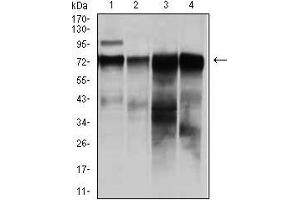 Western blot analysis using RAF1 mouse mAb against HeLa (1), A431 (2), HepG (3), and SW620 (4)cell lysate. (RAF1 抗体)