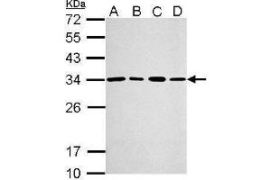 Western Blotting (WB) image for anti-PSME3 (PSME3) antibody (ABIN2856424)