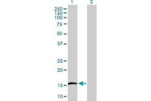 Lane 1: EMP3 transfected lysate ( 18.