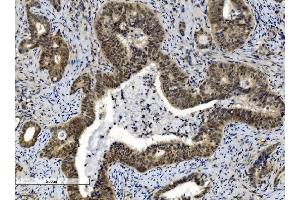 IHC analysis of Cbx8 using anti-Cbx8 antibody (ABIN7599340).