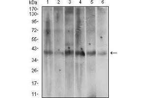 Western blot analysis using ACP5 mouse mAb against A431 (1), T47D (2), HepG2 (3), MOLT4 (4), Jurkat (5) and Hela (6) cell lysate. (ACP5 抗体  (AA 221-325))