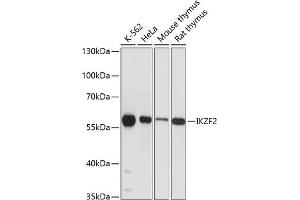 Western blot analysis of extracts of various cell lines, using IKZF2 antibody (ABIN6130817, ABIN6142288, ABIN6142289 and ABIN6215874) at 1:3000 dilution. (IKZF2 抗体  (AA 300-440))