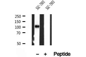 Western blot analysis of extracts of SGC-7901 cells, using PPP1R15B antibody. (PPP1R15B 抗体)