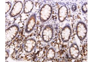 Immunoperoxidase of monoclonal antibody to BCAP29 on formalin-fixed paraffin-embedded human colon. (BCAP29 抗体  (AA 125-241))