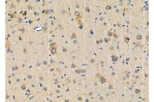 ABIN6257824 and ABIN6274609 at 1/100 staining Rat brain tissue by IHC-P. (CADM3 抗体  (Internal Region))