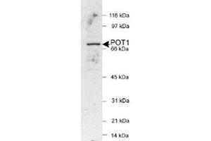 Western blot analysis of POT1 in HeLa nuclear extracts (25 ug) with POT1 polyclonal antibody . (POT1 抗体  (AA 200-300))
