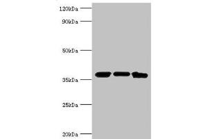 Western blot All lanes: MDH2 antibody at 4 μg/mL Lane 1: Mouse lung tissue Lane 2: 293T whole cell lysate Lane 3: K562 whole cell lysate Secondary Goat polyclonal to rabbit IgG at 1/10000 dilution Predicted band size: 36, 31 kDa Observed band size: 36 kDa (MDH2 抗体  (AA 59-338))