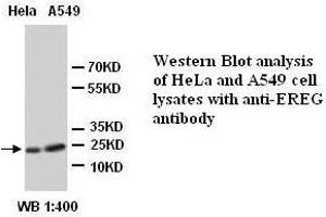 Image no. 1 for anti-Epiregulin (EREG) (Internal Region) antibody (ABIN790928)