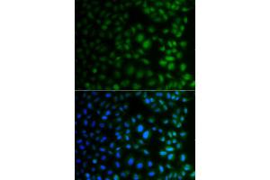 Immunofluorescence analysis of A549 cells using NAA40 antibody (ABIN4904481). (NAA40 抗体)