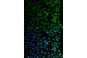Immunofluorescence analysis of A549 cells using NAA40 antibody (ABIN4904481). (NAA40 抗体)