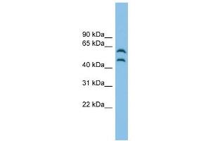CSK antibody used at 1 ug/ml to detect target protein. (CSK 抗体  (Middle Region))