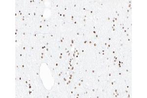 ABIN6266861 at 1/100 staining human brain tissue sections by IHC-P.