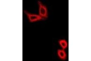Immunofluorescent analysis of Hexokinase 2 staining in U2OS cells. (Hexokinase 2 抗体)