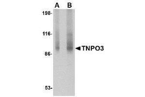 Image no. 1 for anti-Transportin 3 (TNPO3) (N-Term) antibody (ABIN1494360) (Transportin 3 抗体  (N-Term))