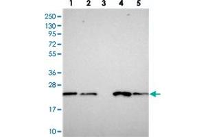 Western blot analysis of Lane 1: RT-4, Lane 2: U-251 MG, Lane 3: Human Plasma, Lane 4: Liver, Lane 5: Tonsil with COMMD2 polyclonal antibody  at 1:250-1:500 dilution. (COMMD2 抗体)