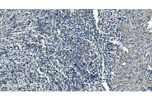 IHC analysis of TIMM8A/DDP using anti-TIMM8A/DDP antibody (ABIN7600039). (TIMM8A/DDP 抗体  (AA 14-97))