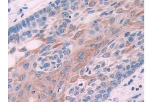 Immunohistochemistry (IHC) image for anti-Keratin 6C (KRT6C) (AA 163-482) antibody (ABIN7443299)