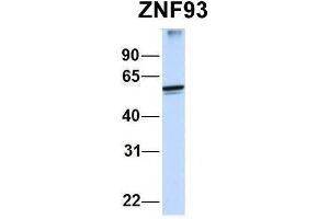 Host:  Rabbit  Target Name:  ZNF93  Sample Type:  Human MCF7  Antibody Dilution:  1. (ZNF93 抗体  (N-Term))