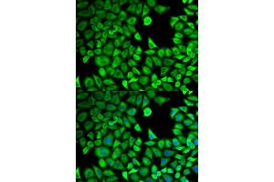 Immunofluorescence analysis of HeLa cells using LTA4H antibody. (LTA4H 抗体)