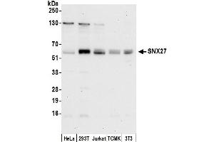 Western Blotting (WB) image for anti-Sorting Nexin 27 (SNX27) (AA 125-175) antibody (ABIN7453207)