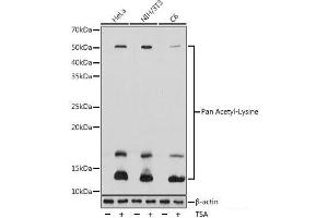 Western blot analysis of extracts of various cell lines using Pan Acetyl-Lysine Polyclonal Antibody at dilution of 1:1000. (Acetylated Lysine 抗体)