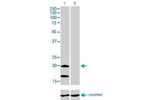 Western blot analysis of NDUFS4 over-expressed 293 cell line, cotransfected with NDUFS4 Validated Chimera RNAi (Lane 2) or non-transfected control (Lane 1).