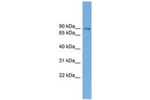 Image no. 1 for anti-UTP14, U3 Small Nucleolar Ribonucleoprotein, Homolog A (UTP14A) (AA 143-192) antibody (ABIN6744948)
