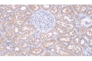 Detection of IDUa in Human Kidney Tissue using Polyclonal Antibody to Iduronidase Alpha L (IDUa) (IDUA 抗体  (AA 28-306))