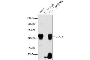 Immunoprecipitation analysis of 200 μg extracts of LO2 cells using 3 μg GSK3β antibody . (GSK3 beta 抗体)