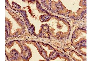 Immunohistochemistry of paraffin-embedded human prostate tissue using ABIN7147903 at dilution of 1:100 (Claudin 3 抗体  (AA 181-220))