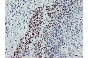 Image no. 1 for anti-Tumor Protein P53 (TP53) antibody (ABIN1499967) (p53 抗体)