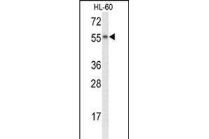 Western blot analysis of NYX Antibody (N-term) (ABIN653436 and ABIN2842877) in HL-60 cell line lysates (35 μg/lane). (Nyctalopin 抗体  (N-Term))