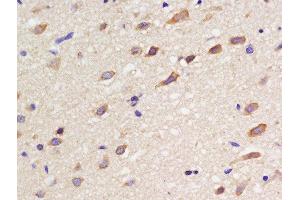Formalin-fixed and paraffin embedded rat brain labeled with Rabbit Anti-SSTR3 Polyclonal Antibody, Unconjugated  at 1:200 followed by conjugation to the secondary antibody and DAB staining (SSTR3 抗体)