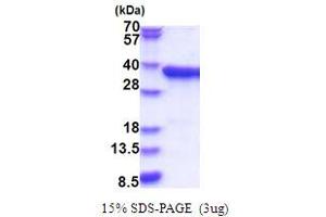 SDS-PAGE (SDS) image for Pyrophosphatase 2 (PPA2) (AA 33-334) protein (His tag) (ABIN5853823) (PPA2 Protein (AA 33-334) (His tag))