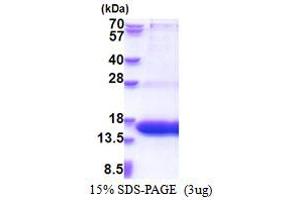 SDS-PAGE (SDS) image for WW and C2 Domain Containing 1 (WWC1) (AA 655-783) protein (His tag) (ABIN5853532)