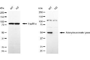 Western blotting analysis using adenylosuccinate lyase antibody (ABIN7797524). (Adenylosuccinate Lyase 抗体)