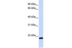 Image no. 1 for anti-Chromosome 21 Open Reading Frame 56 (C21orf56) (AA 108-157) antibody (ABIN6740942) (C21ORF56 抗体  (AA 108-157))