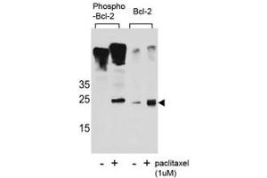 Western Blotting (WB) image for anti-B-Cell CLL/lymphoma 2 (BCL2) (pSer70) antibody (ABIN3030098)