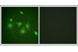 Immunofluorescence analysis of HepG2 cells, using HDAC6 Antibody.