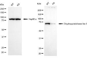 Western blotting analysis using dihydropyrimidinase like 3 antibody (ABIN7798338). (Recombinant DPYSL3 抗体)