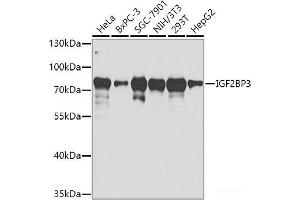 Western blot analysis of extracts of various cell lines using IGF2BP3 Polyclonal Antibody at dilution of 1:1000. (IGF2BP3 抗体)